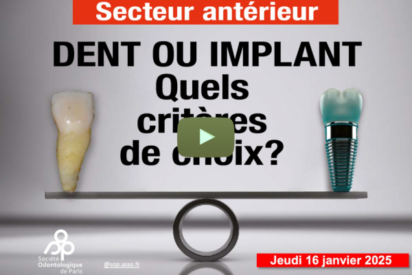 Replay Journée « Dent ou implant »